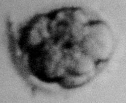 James, seven celled embryo, two days after conception
