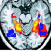 brain fMRI