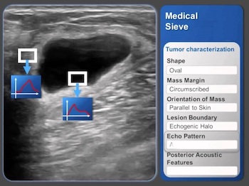 Interface of Medical Sieve, an algorithm by IBM for assisting in clinical decisions.