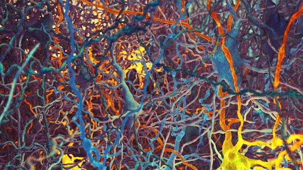 Tangle of neurons