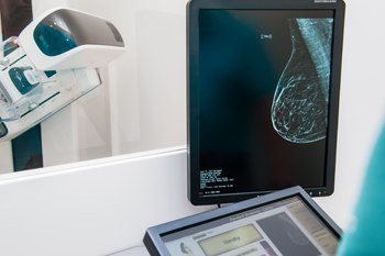 mammogram