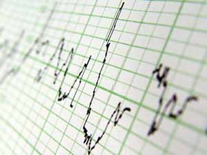 ecg