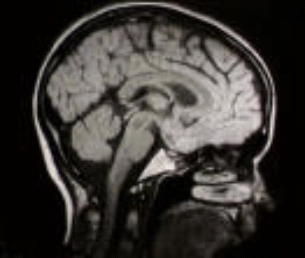 A CAT scan of the inside of a head.