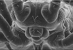 Figure 3: Electron microscope picture of a fly. The resolving power of an optical lens depends on the wavelength of the light used. An electron-microscope exploits the wave-like properties of particles to reveal details that would be impossible to see with visible light.