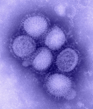 The H1N1 virus