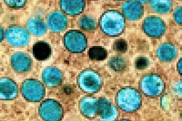 virus particles