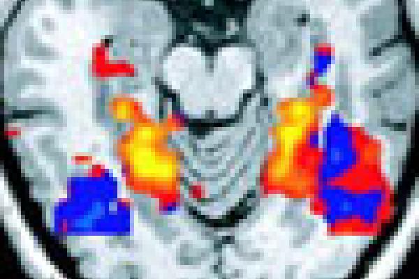 brain fMRI